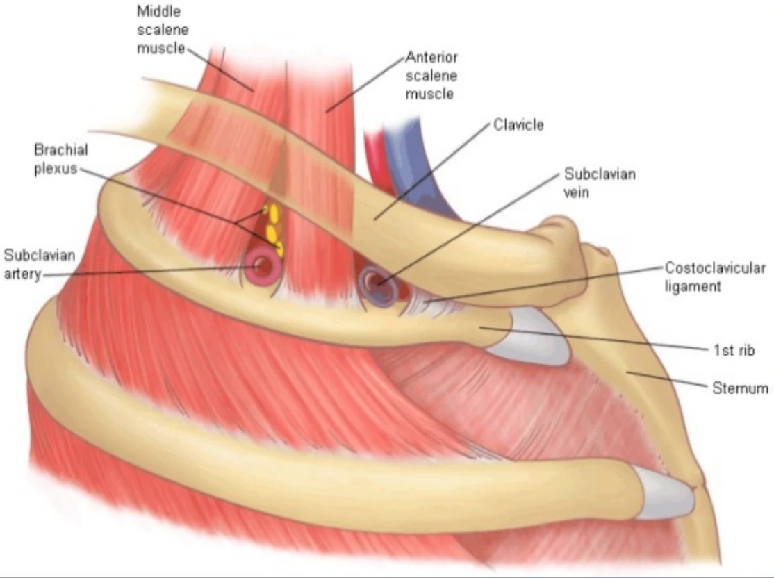 Thoracic outlet anatomy showing the brachial plexus nerves, subclavian artery and vein, scalene muscles, collarbone, and first rib